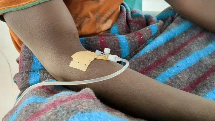 2025 12 08t111800z 1 lynxmpelb70ka rtroptp 3 health cholera congo main